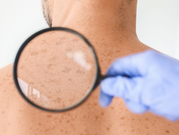 dermatologo che guarda nei